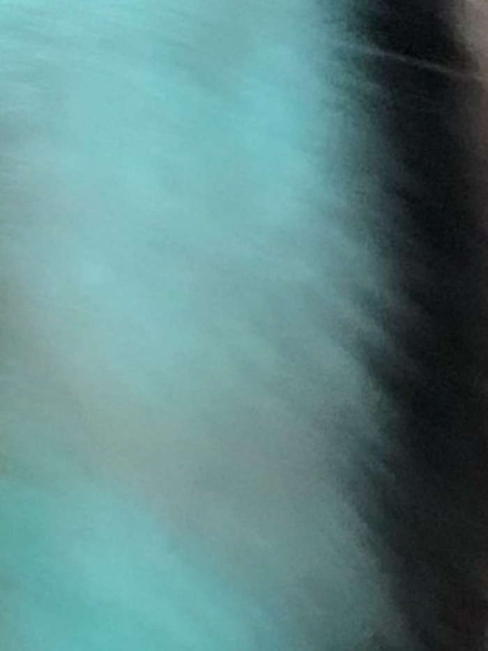 story-img