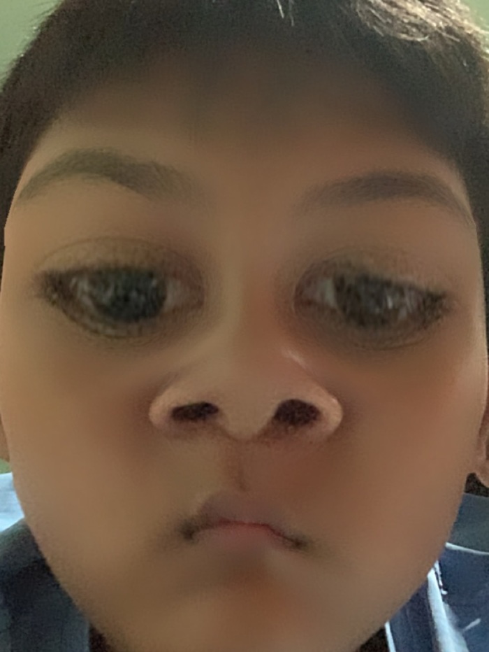 story-img